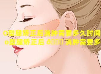 O型腿矫正后消肿需要多久时间(o型腿矫正后 🐈 消肿需要多久时间)